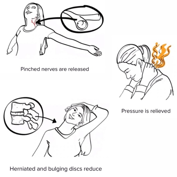 👤🚨EUC Neck Hammock - used TWICE - perfect for relieving neck pain - Picture 9 of 13